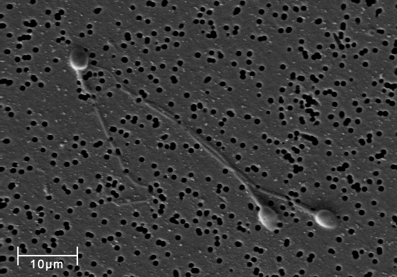 Espermatozoides humanos