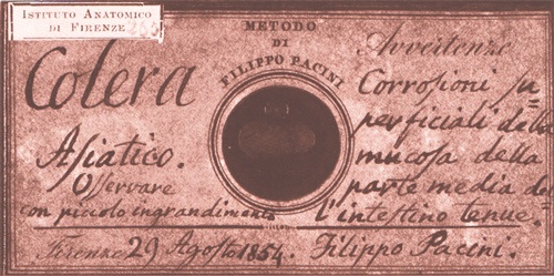 Muestra de Pacini