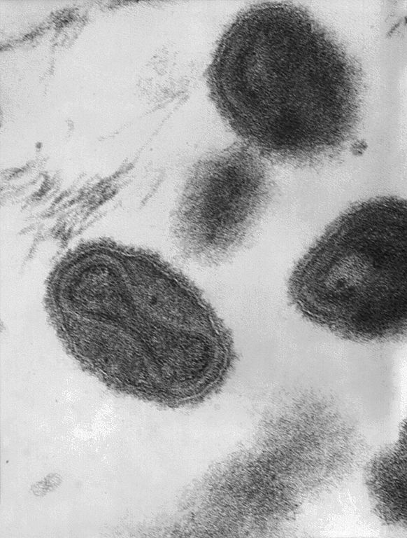 Variola virus